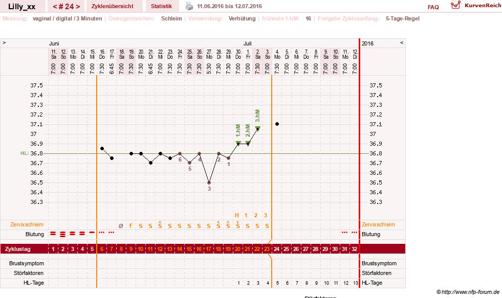 NFP-Kurve User #26447