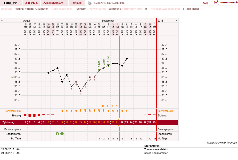 NFP-Kurve User #26447