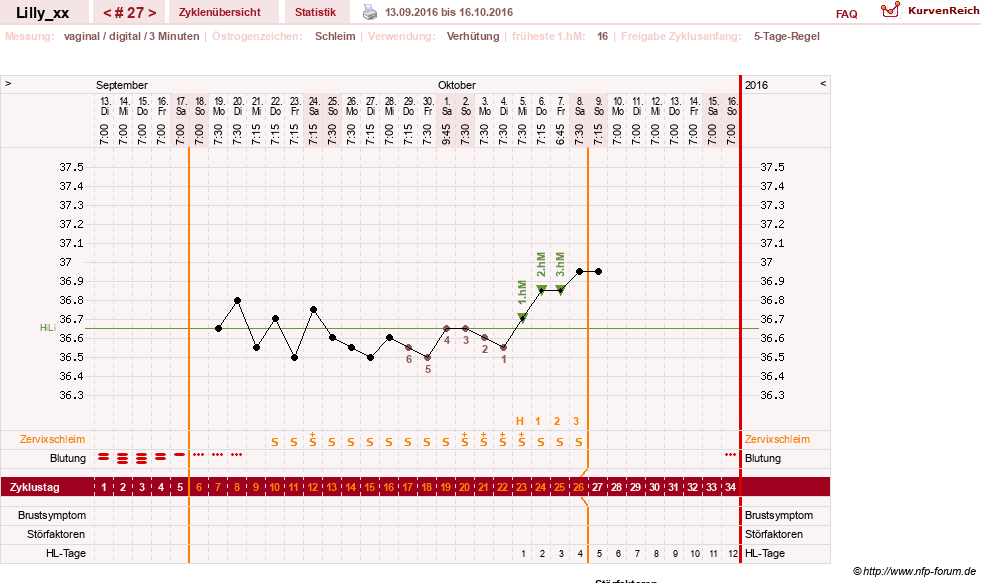 NFP-Kurve User #26447