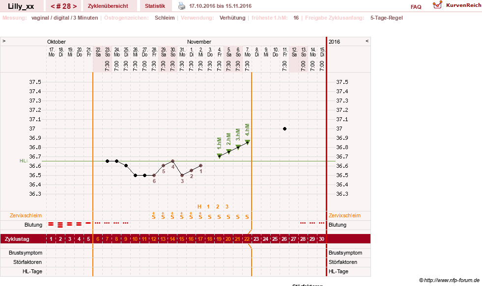 NFP-Kurve User #26447