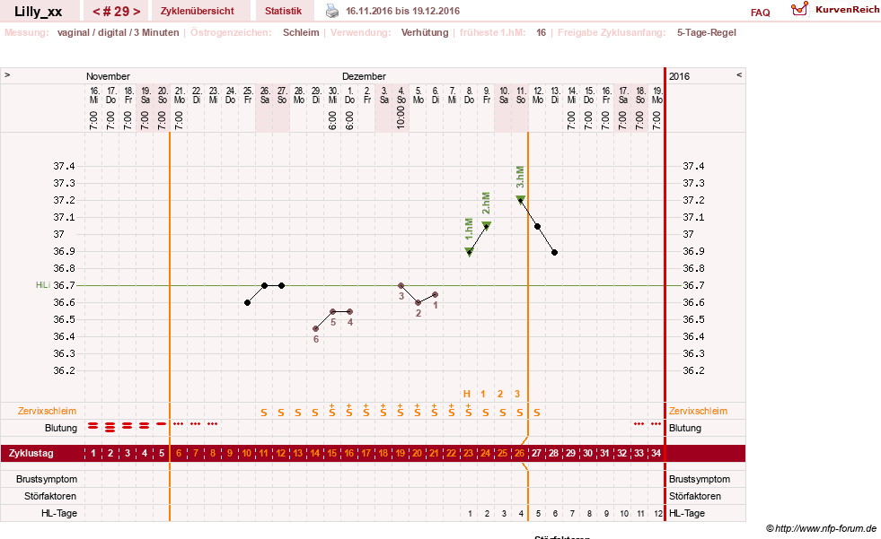 NFP-Kurve User #26447