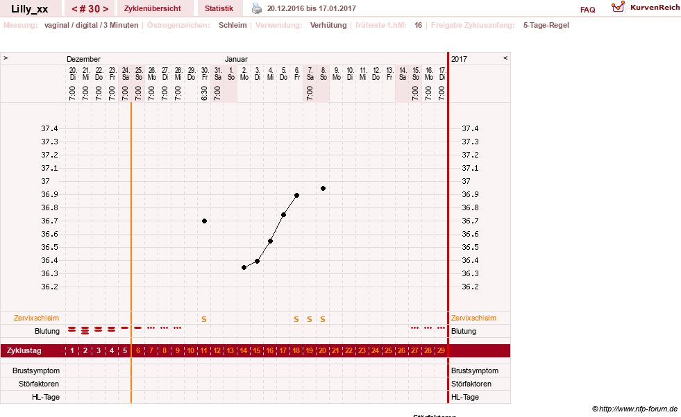 NFP-Kurve User #26447