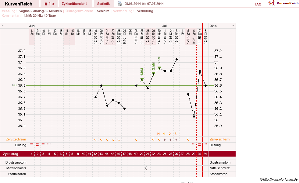 NFP-Kurve User #26503