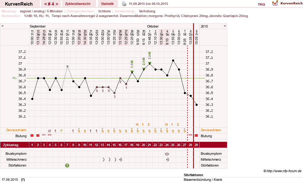 NFP-Kurve User #26503