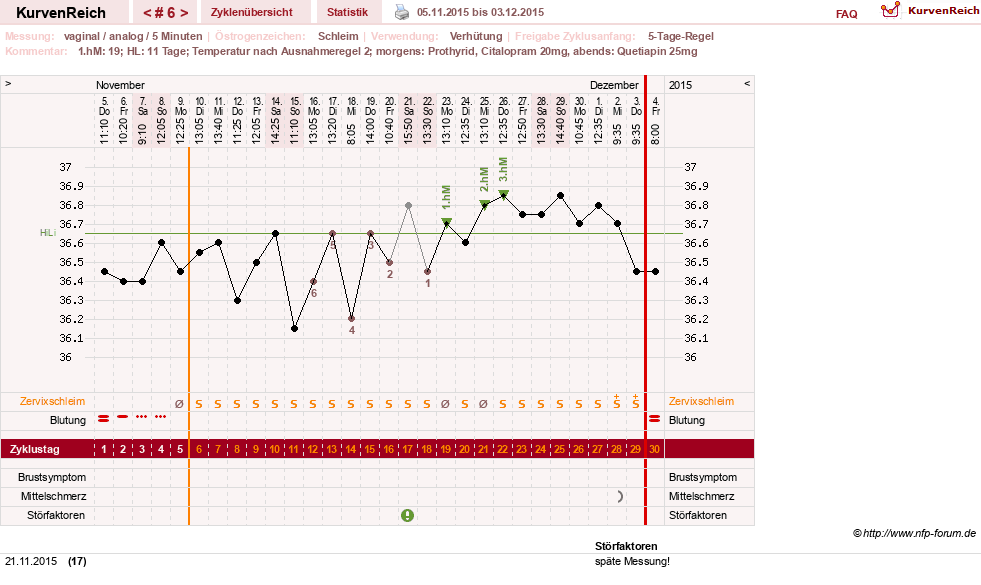 NFP-Kurve User #26503