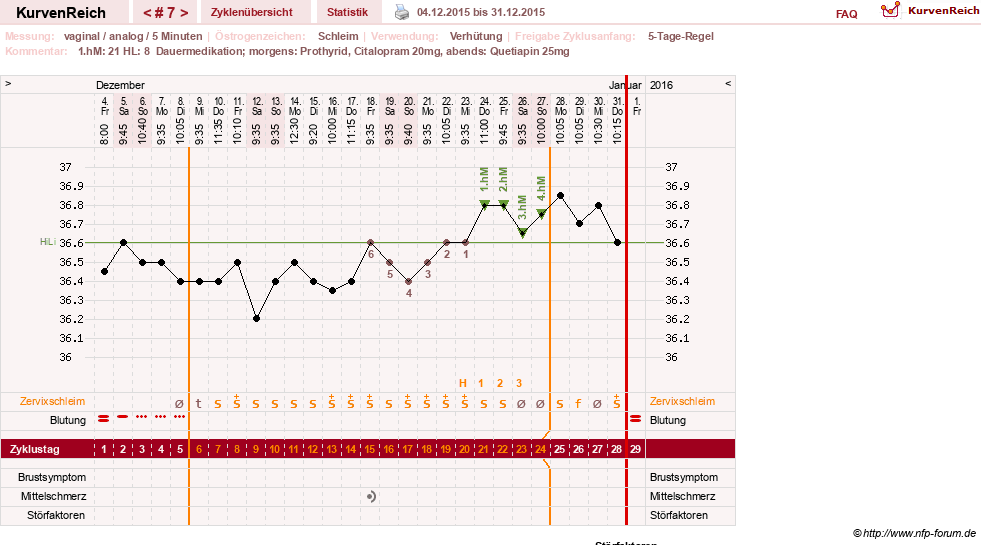 NFP-Kurve User #26503