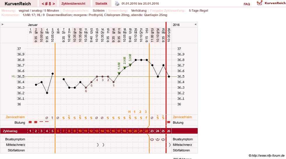 NFP-Kurve User #26503
