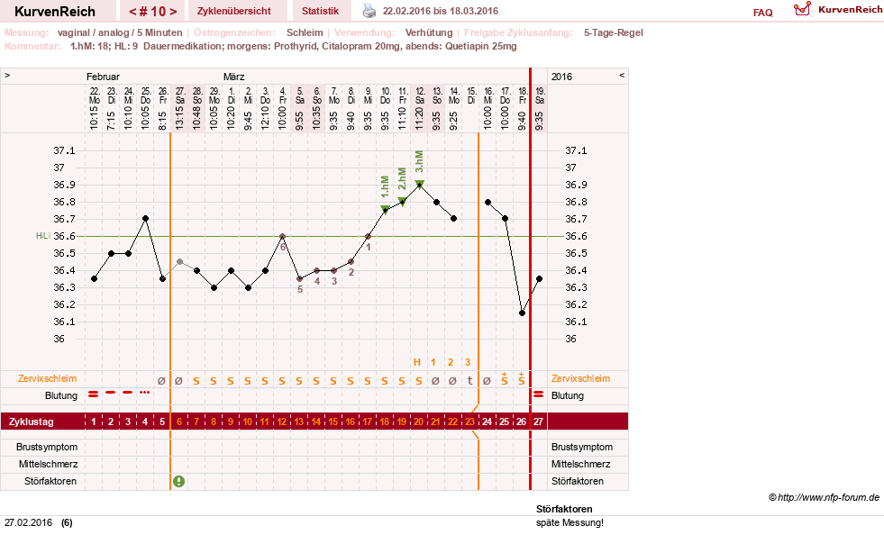 NFP-Kurve User #26503
