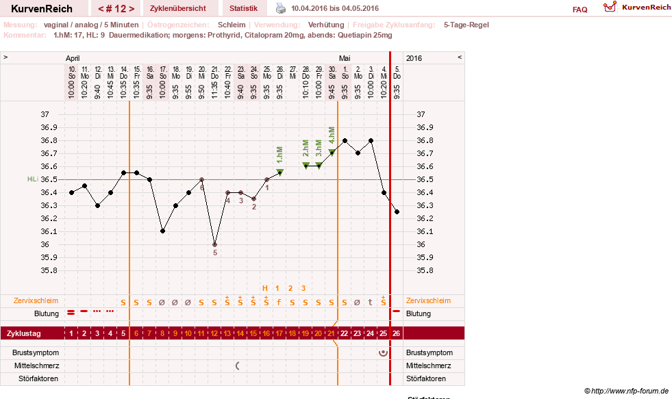 NFP-Kurve User #26503
