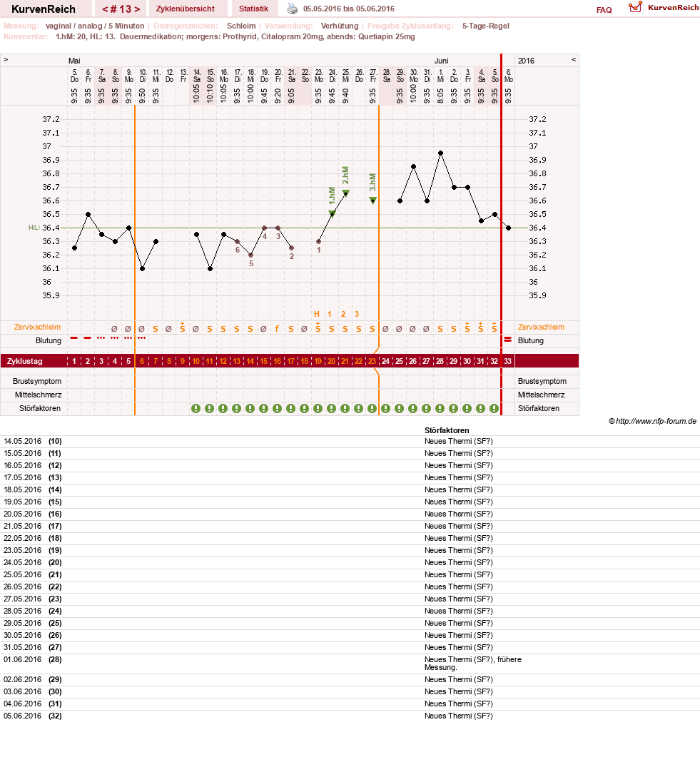 NFP-Kurve User #26503
