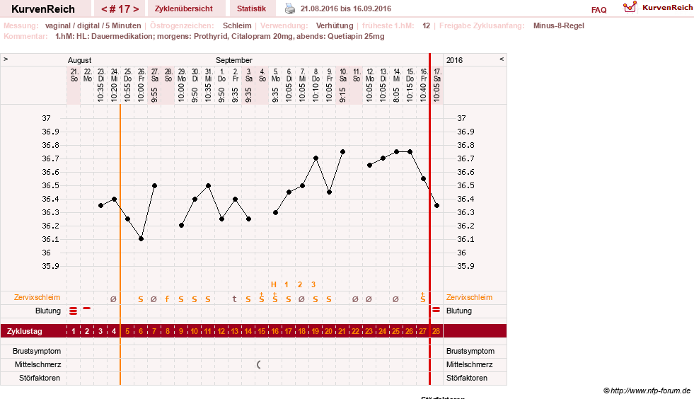 NFP-Kurve User #26503