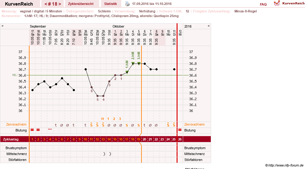 NFP-Kurve User #26503