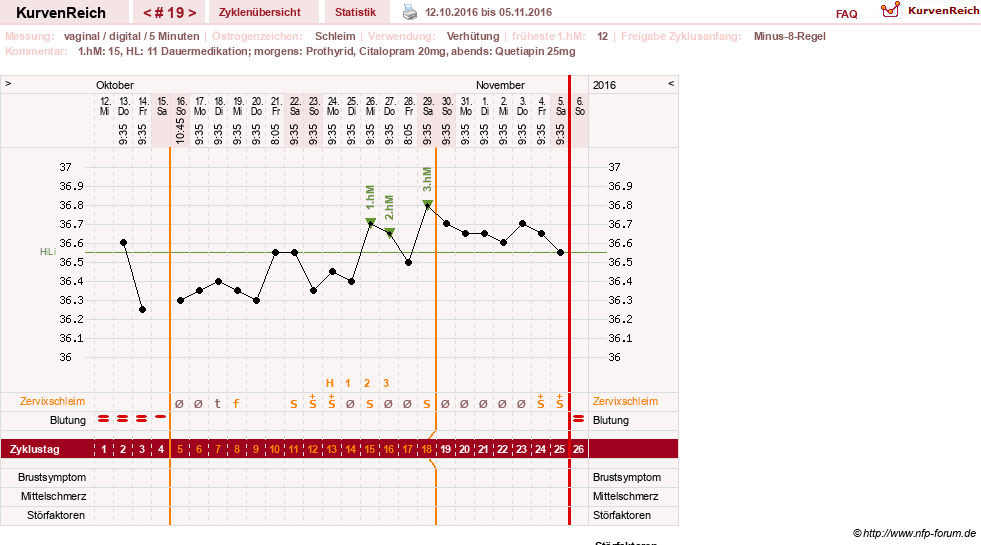 NFP-Kurve User #26503