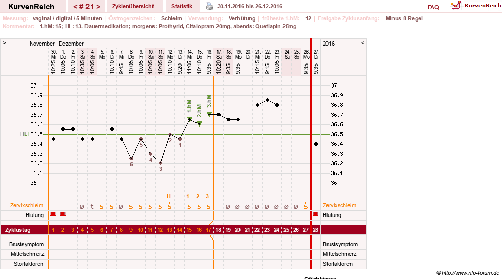 NFP-Kurve User #26503