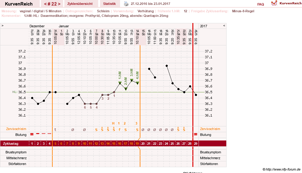 NFP-Kurve User #26503