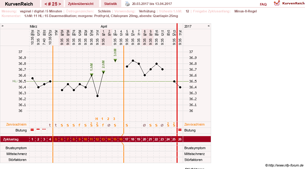 NFP-Kurve User #26503