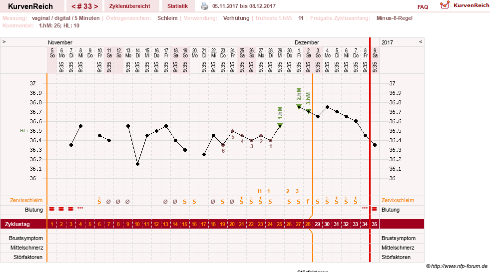 NFP-Kurve User #26503