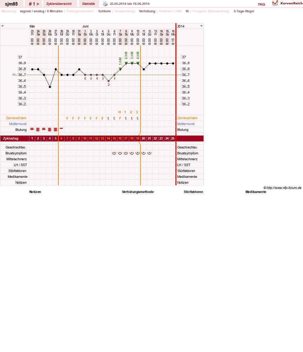 NFP-Kurve User #26514