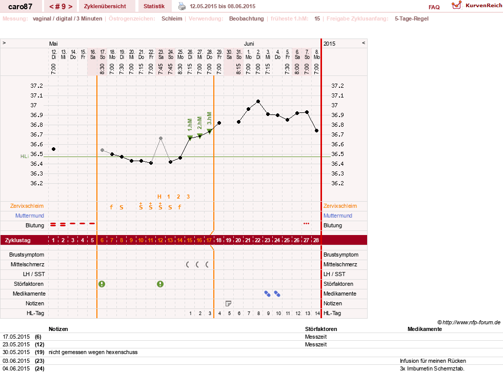 NFP-Kurve User #26580