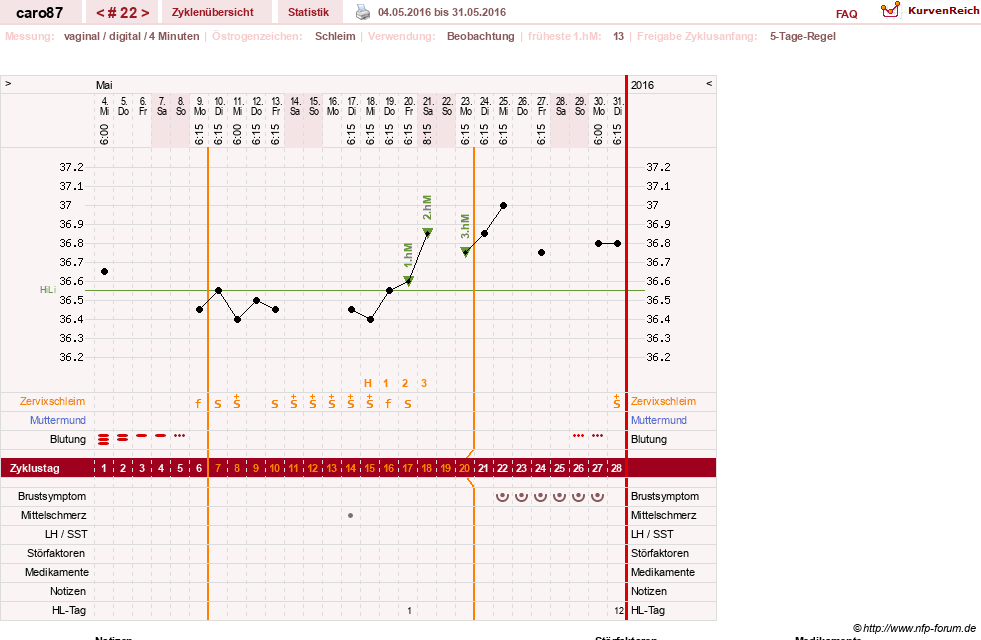 NFP-Kurve User #26580