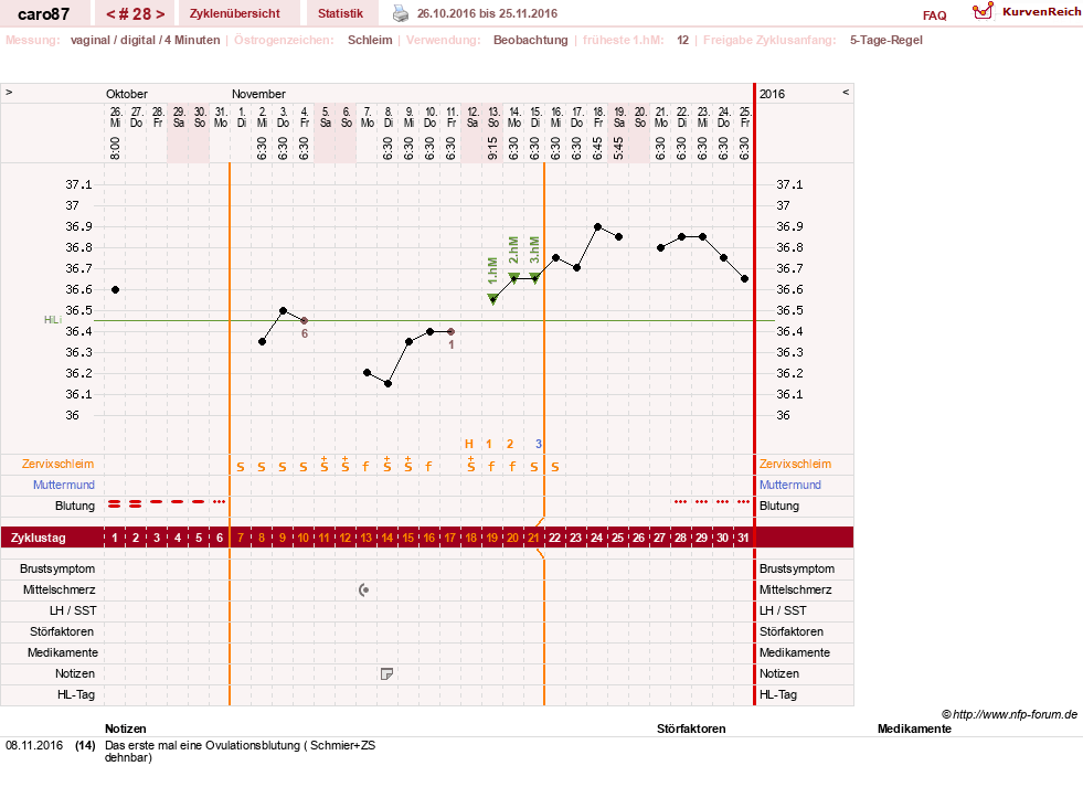 NFP-Kurve User #26580