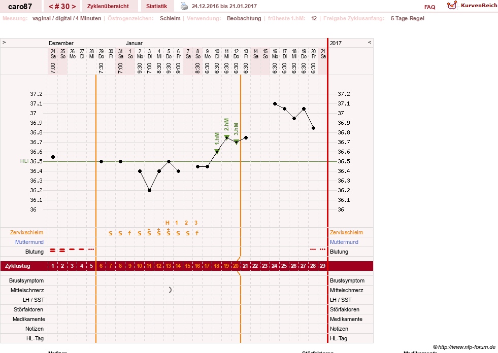 NFP-Kurve User #26580