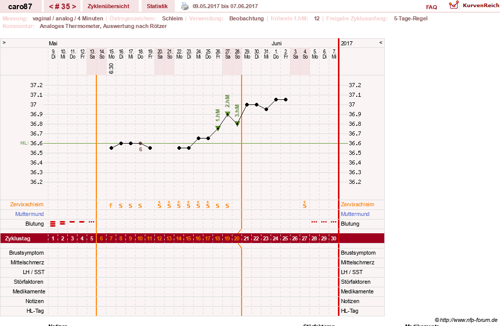 NFP-Kurve User #26580