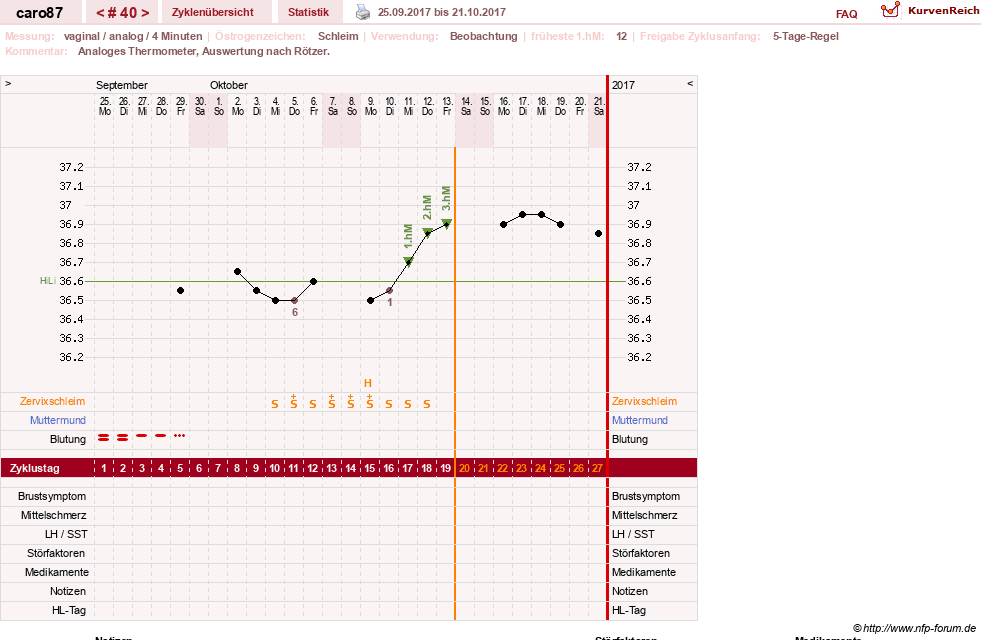 NFP-Kurve User #26580