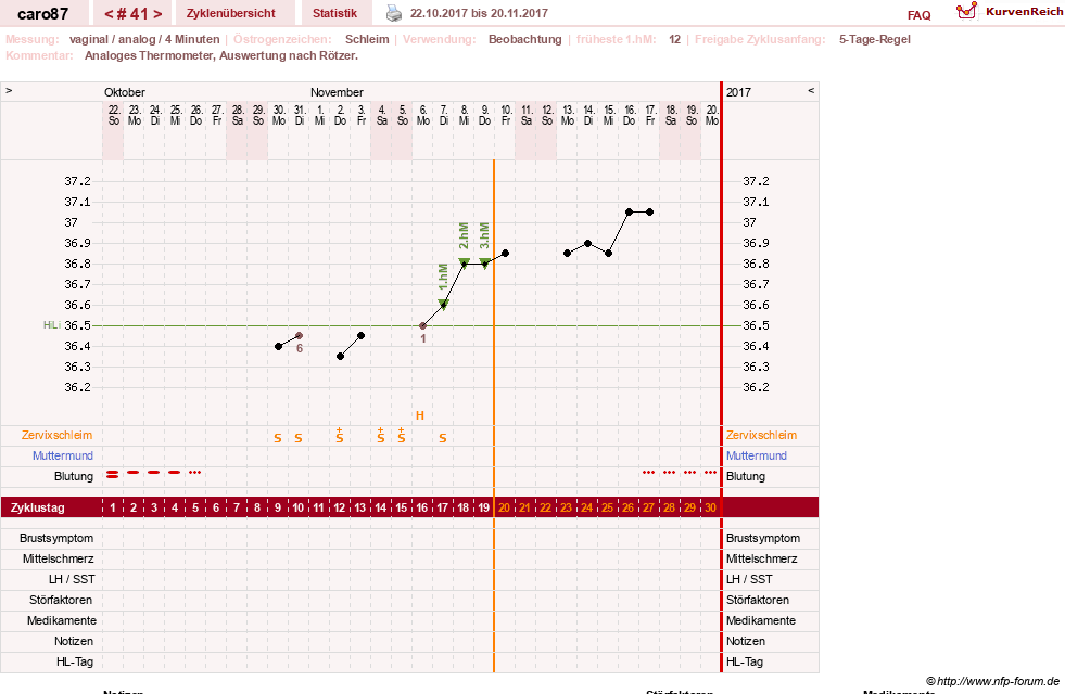 NFP-Kurve User #26580