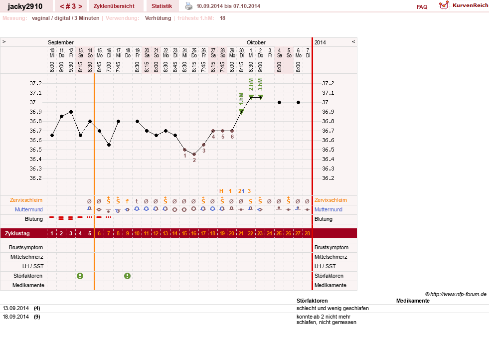 NFP-Kurve User #26594