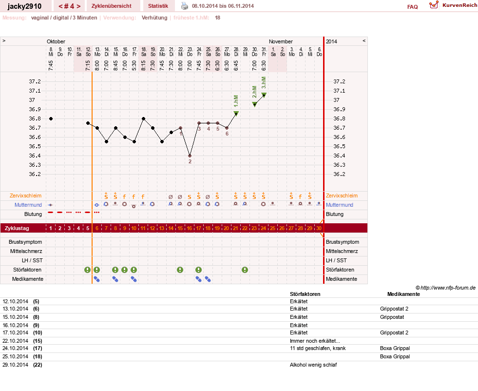NFP-Kurve User #26594
