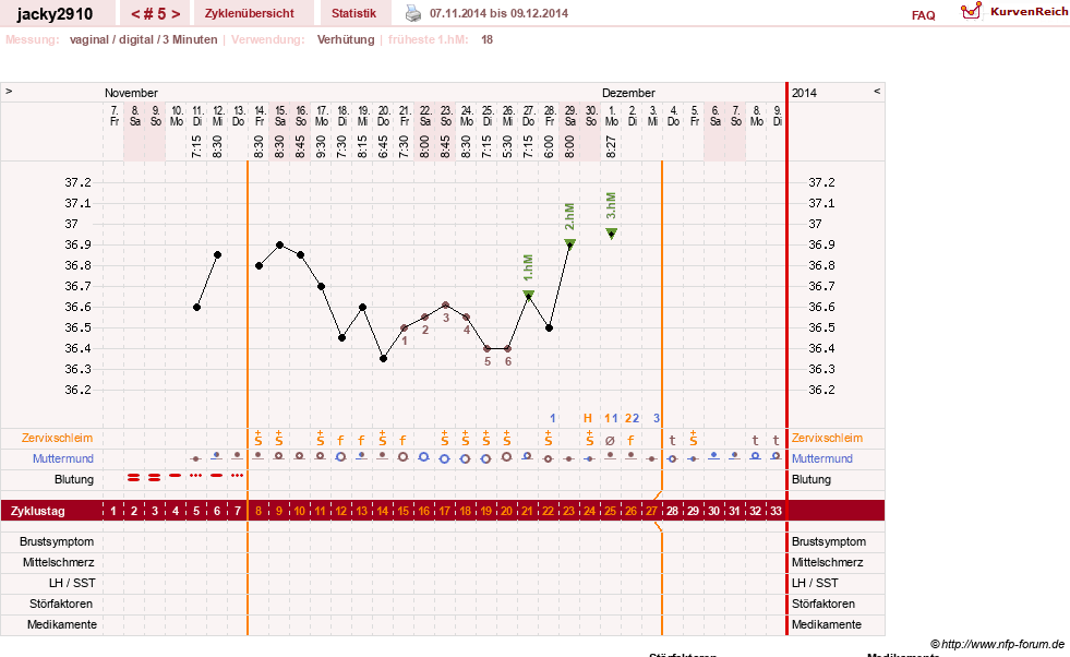 NFP-Kurve User #26594