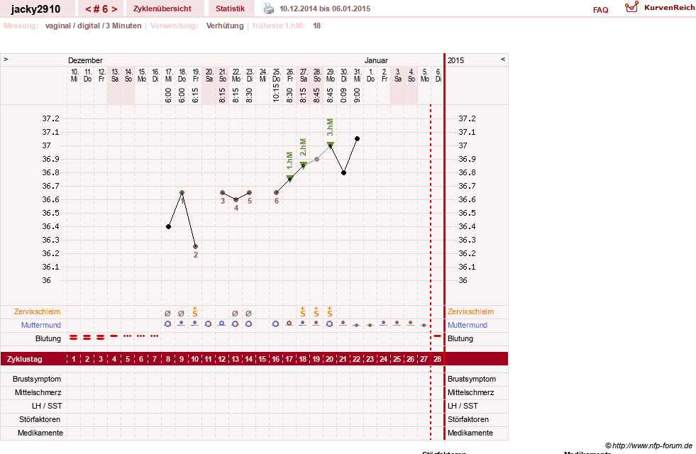 NFP-Kurve User #26594