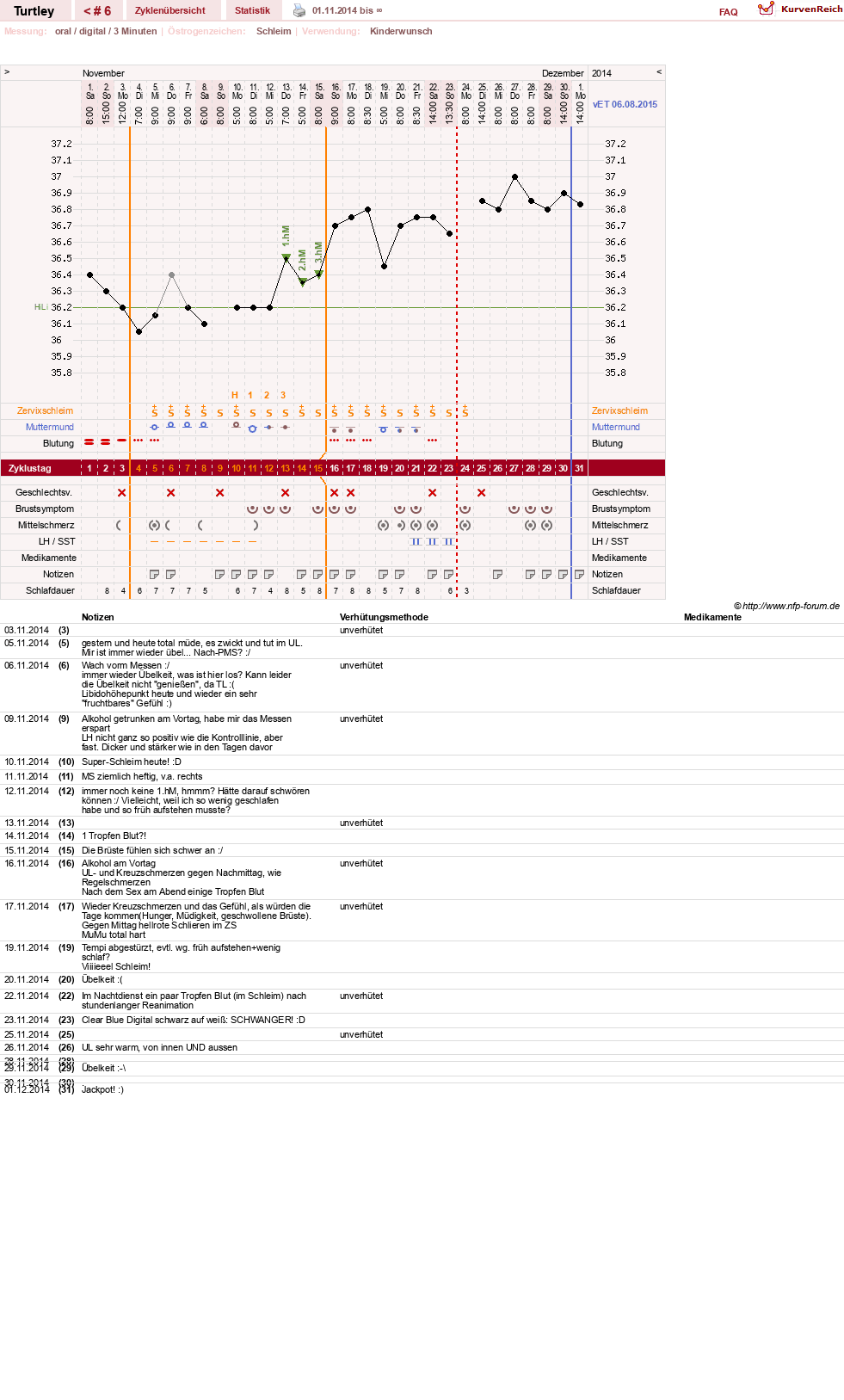 NFP-Kurve User #26598