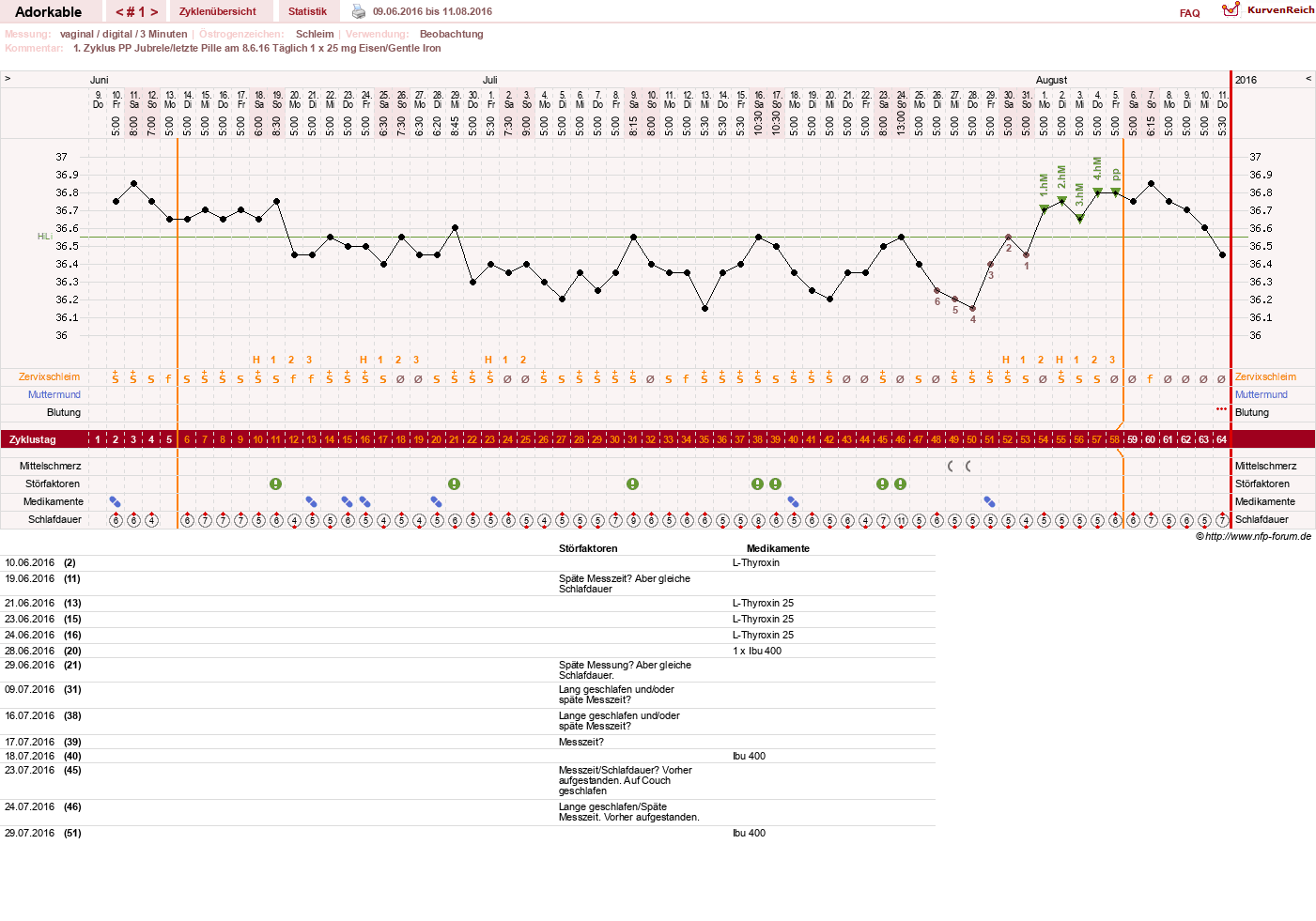 NFP-Kurve User #26649