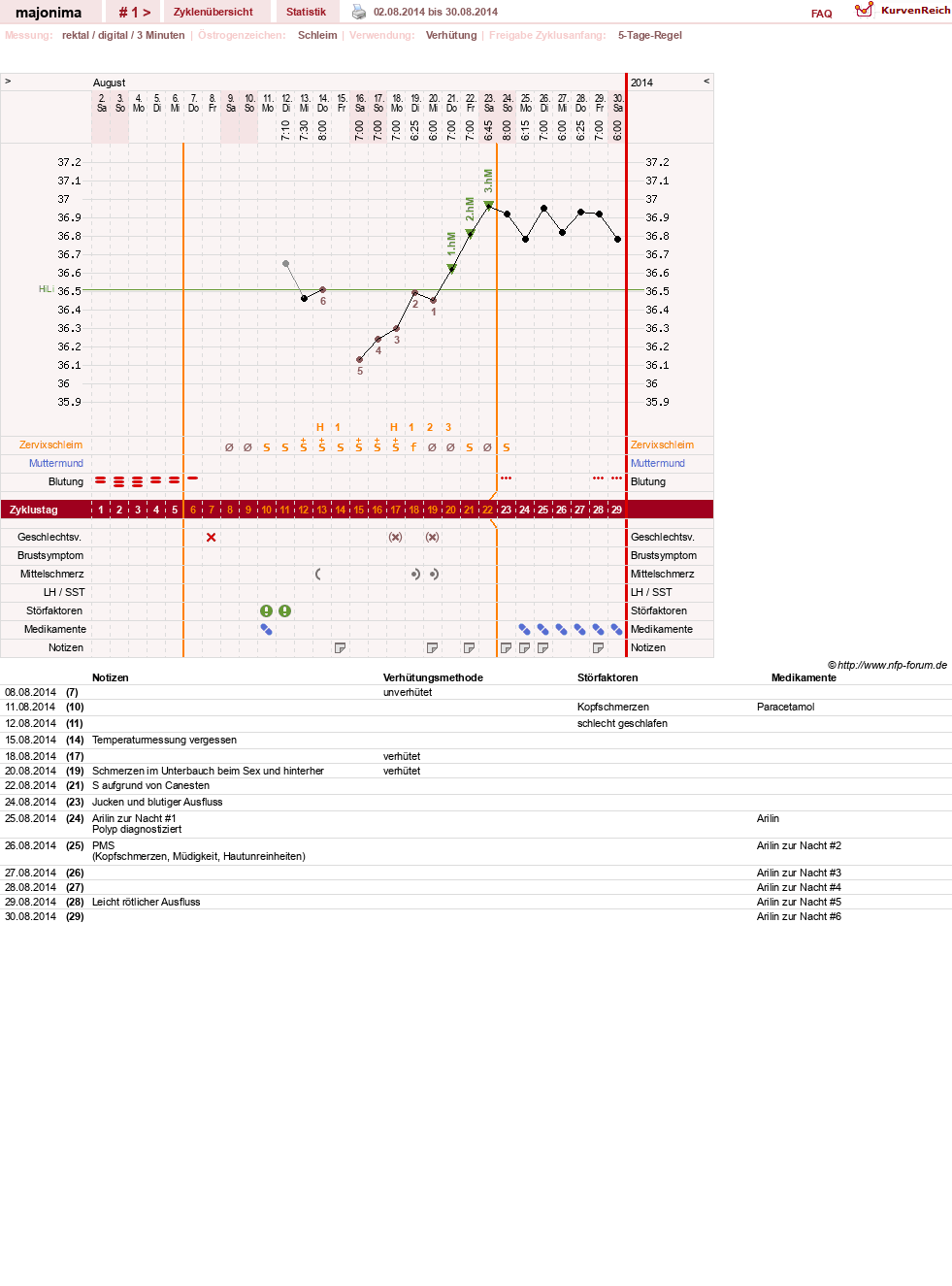 NFP-Kurve User #26750