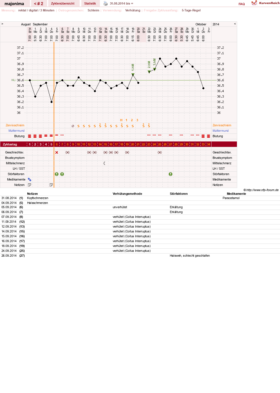 NFP-Kurve User #26750