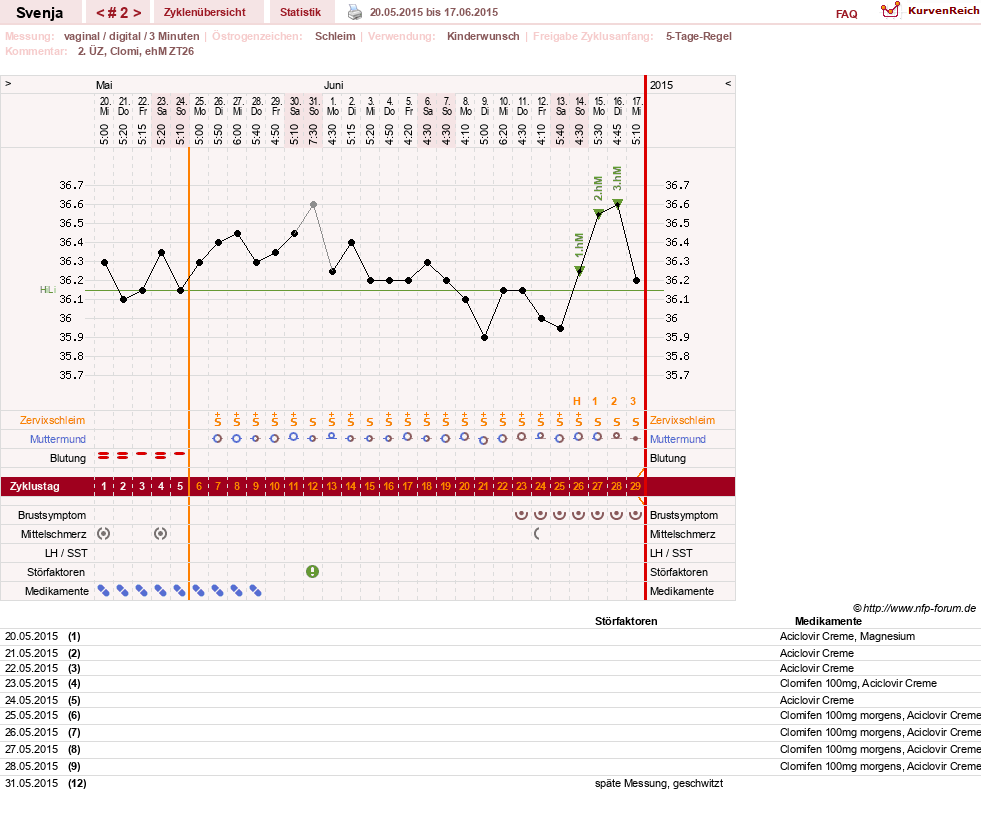 NFP-Kurve User #26849