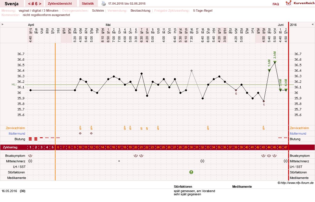 NFP-Kurve User #26849