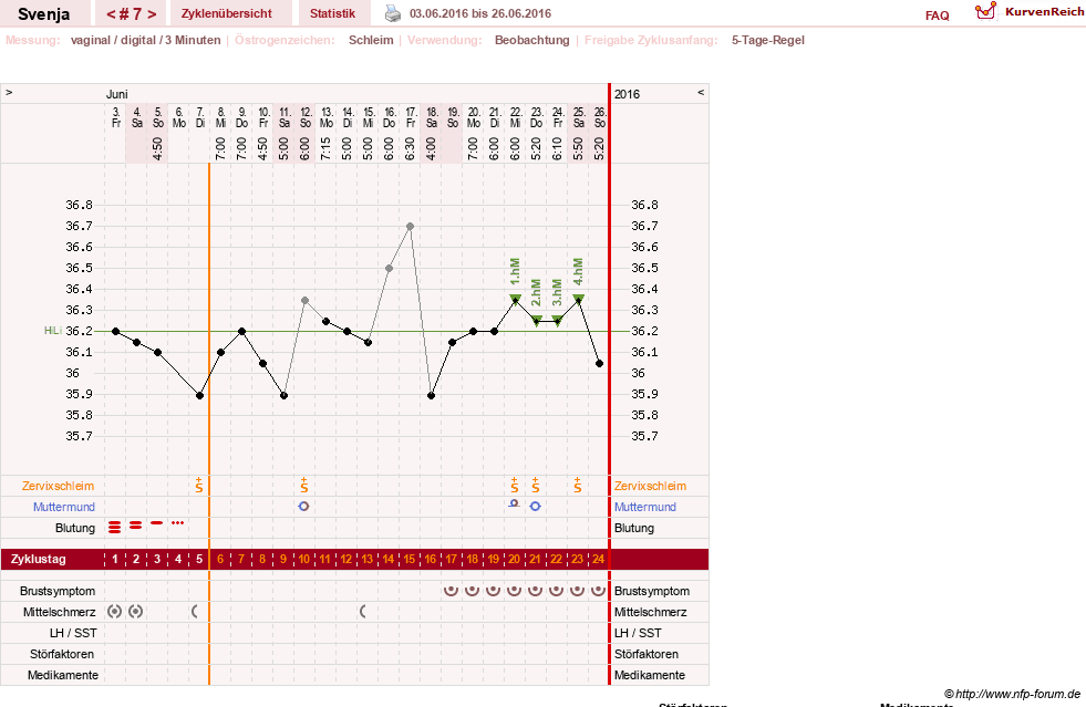 NFP-Kurve User #26849