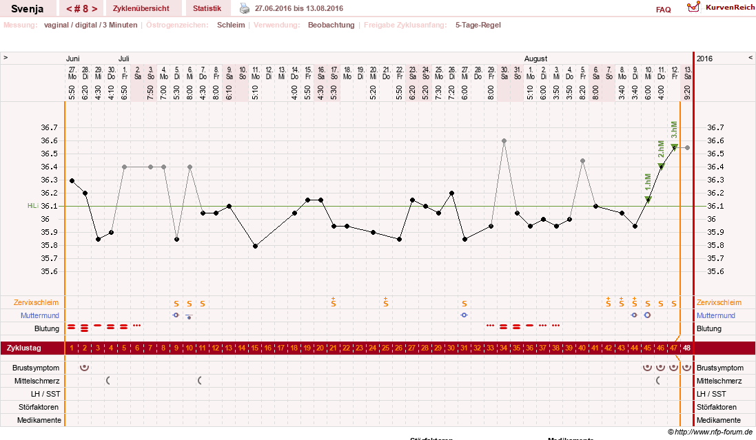 NFP-Kurve User #26849