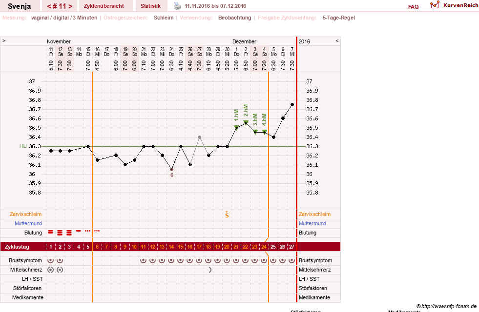 NFP-Kurve User #26849