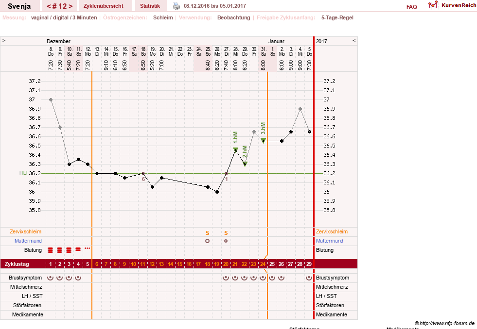 NFP-Kurve User #26849