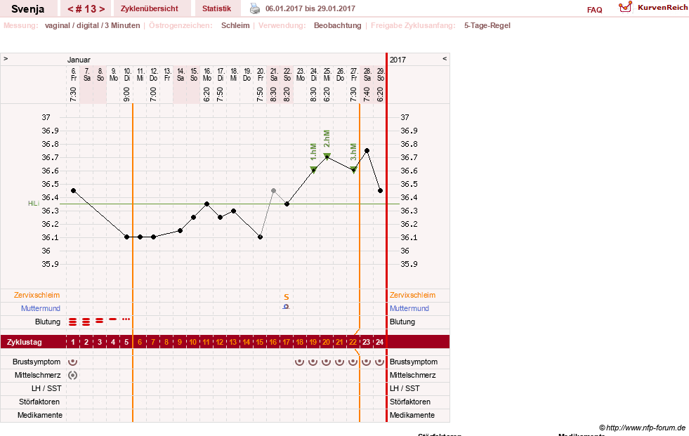 NFP-Kurve User #26849