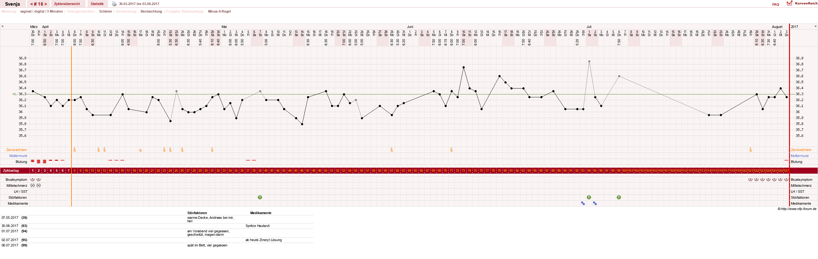 NFP-Kurve User #26849