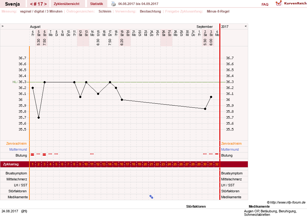 NFP-Kurve User #26849