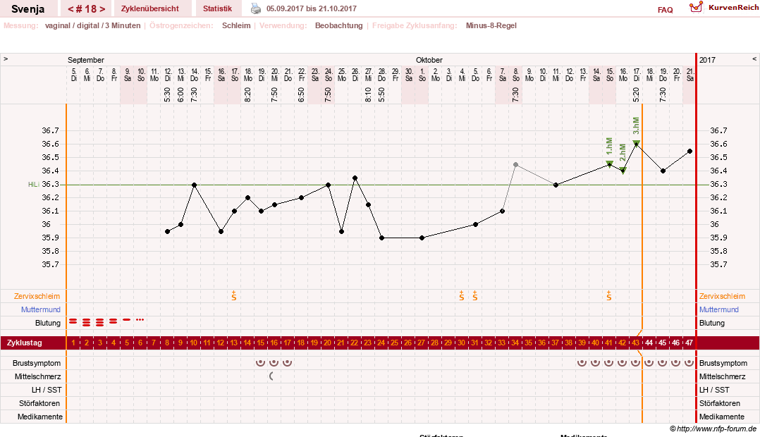 NFP-Kurve User #26849