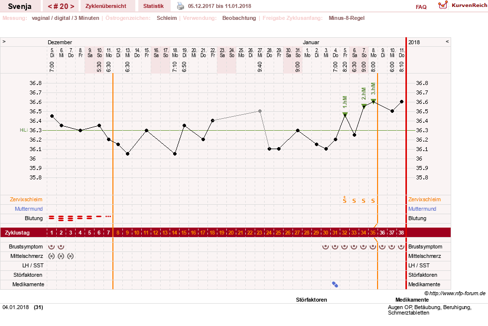 NFP-Kurve User #26849