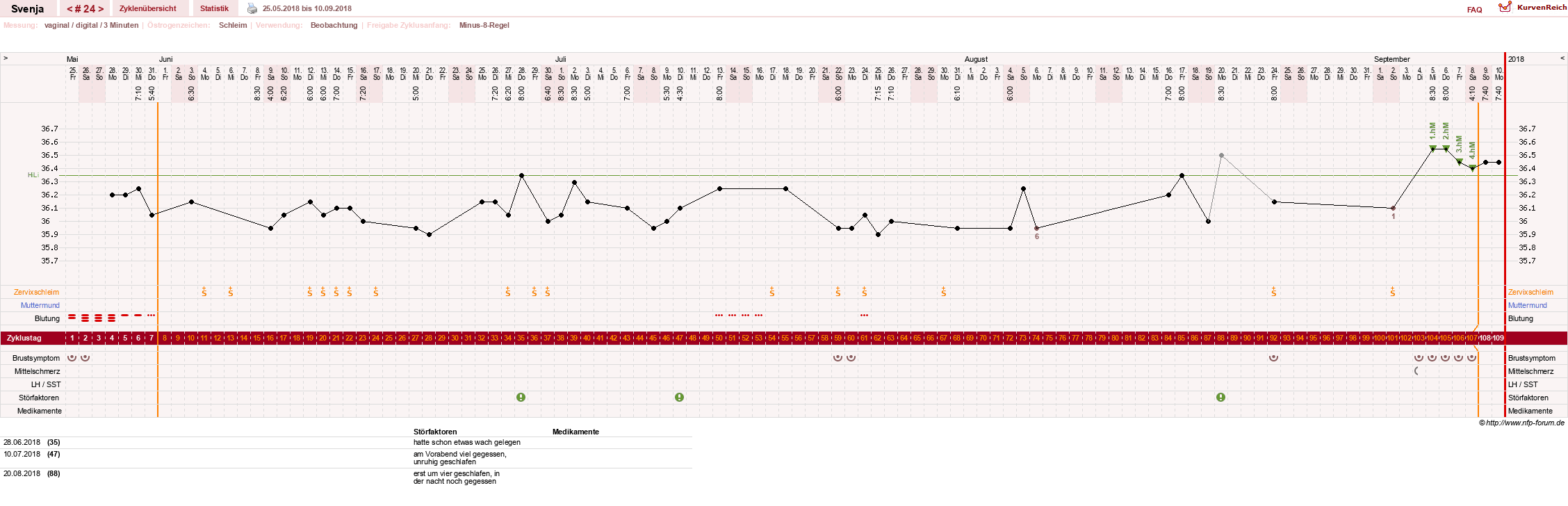 NFP-Kurve User #26849