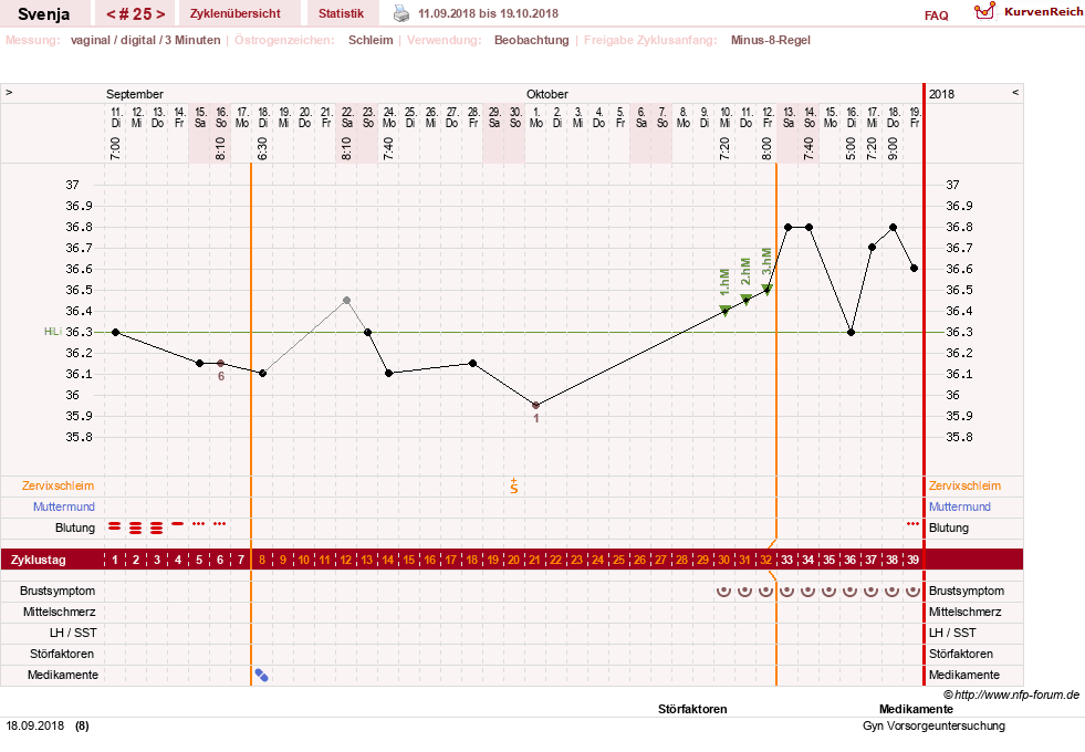 NFP-Kurve User #26849